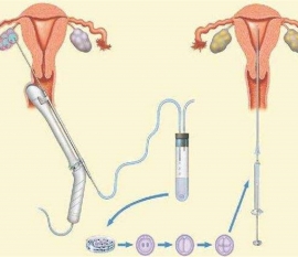 35岁女性备孕请做好以下检查，“健康贵阳代生宝宝”跑不远